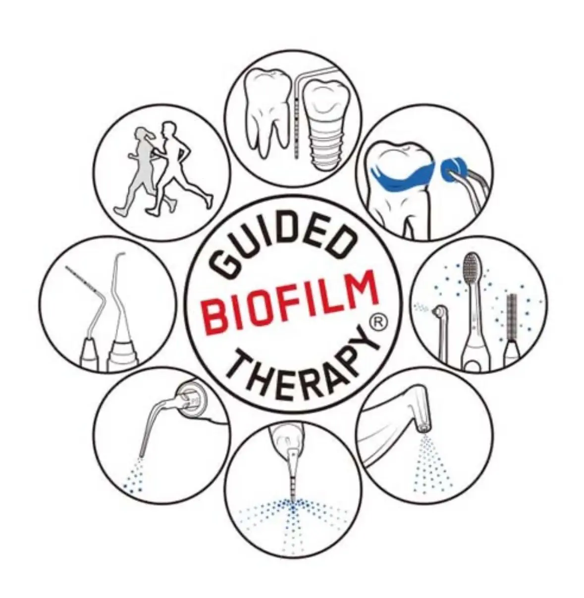 歯周病予防プログラム　エアフロー　プラーク除去