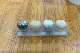 保険診療と自費診療　被せもの　保険と自費素材の比較