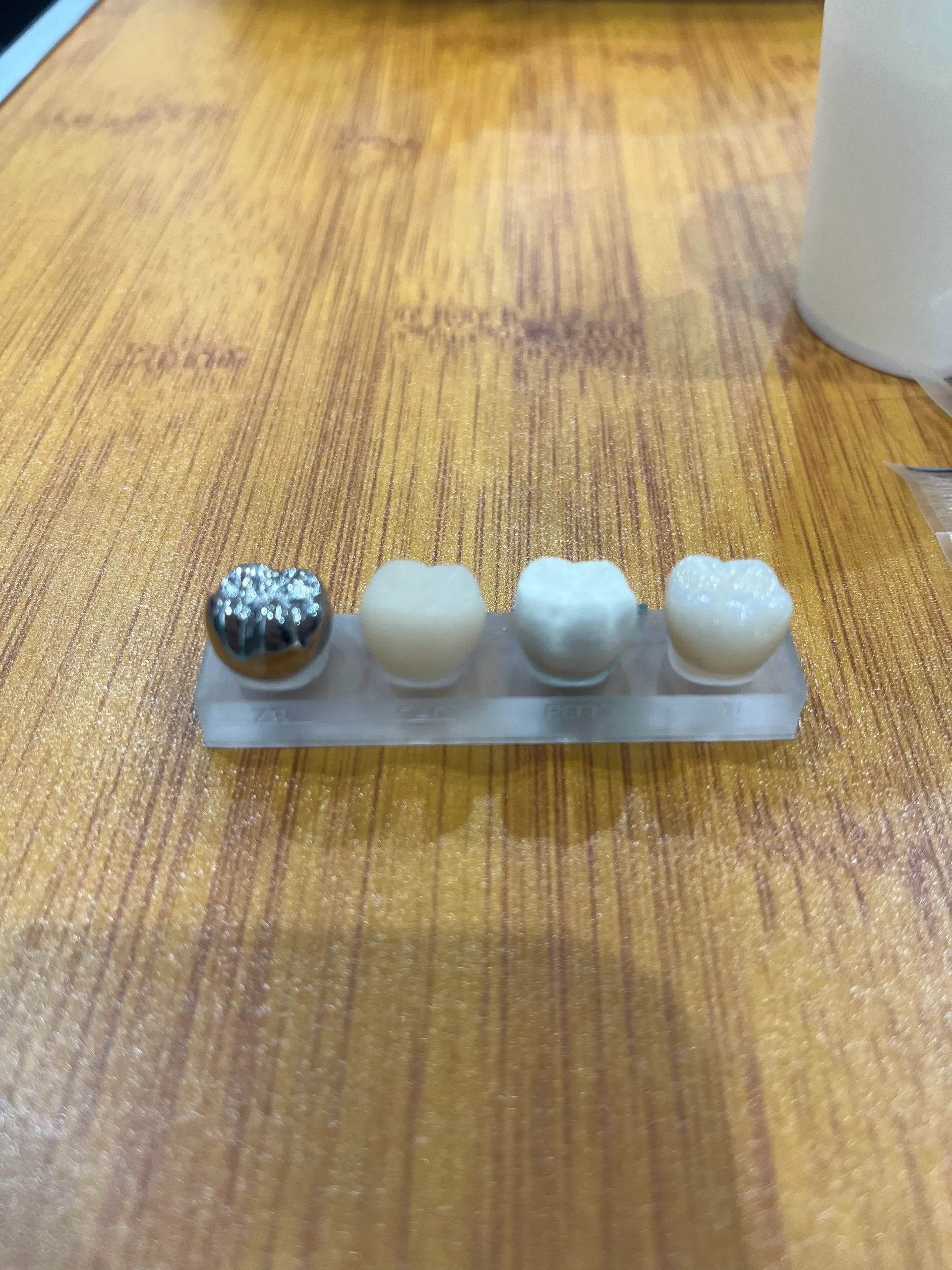 保険診療と自費診療 被せもの 保険と自費素材の比較