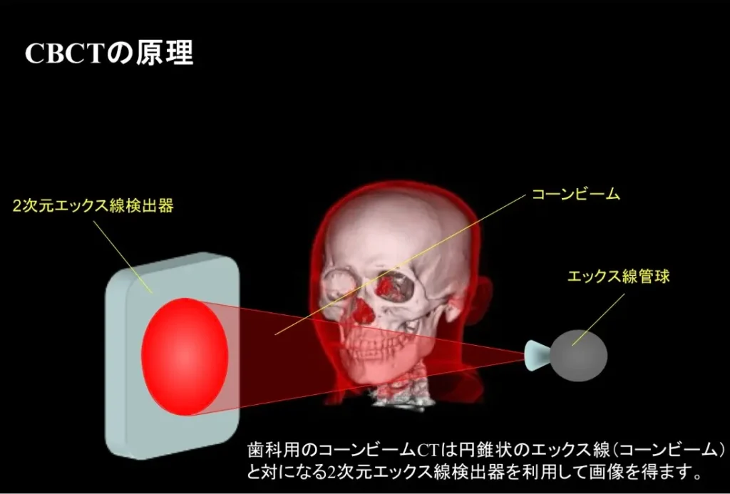 CBCTの原理　歯科用コーンビームCT　２次元エックス線検出器