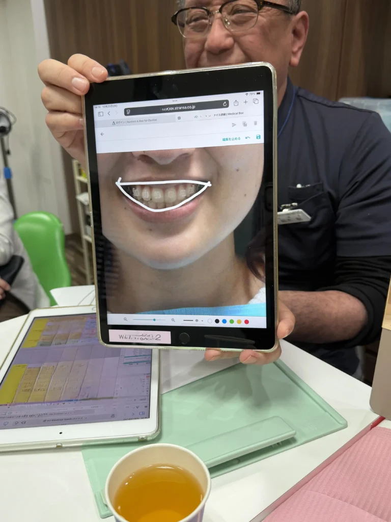 スマイルライン　口角　口腔内写真