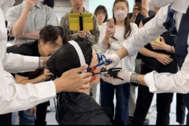 嚙み合わせ 登戸矯正 顎関節の動き