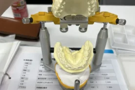 非抜歯矯正 登戸矯正 かみ合わせ相談