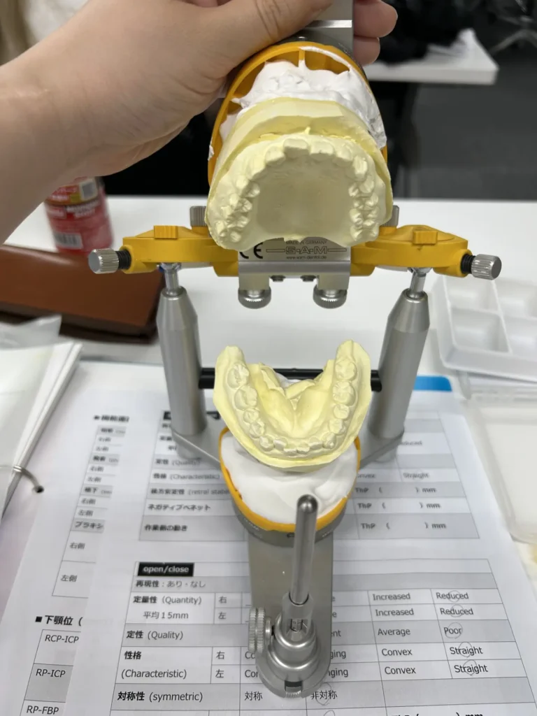 かみ合わせ模型　登戸矯正　クローバー歯科矯正歯科