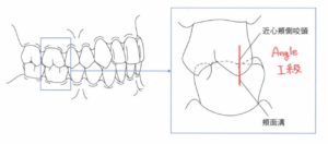 不正咬合　上下額の咬合　かみ合わせ