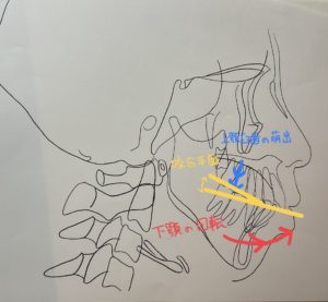 咬合関係　咬み合わせ　歯並び