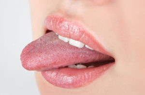舌の痛み　舌の違和感　舌がヒリヒリする　