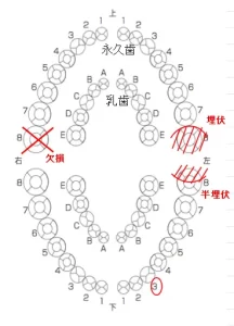 乳歯　永久歯　生えかわり