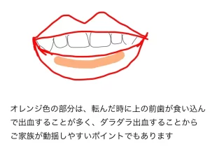 転んだ　歯科　口腔外科